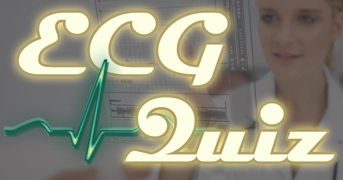 (c) Ecg-quiz.com
